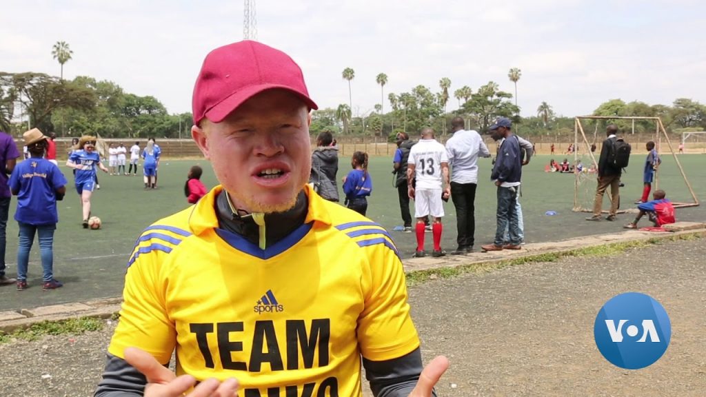 World's First Albino Soccer Team is Kenya’s Black Albinism Football Club